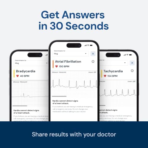 EcoSource Personal ECG Monitor — Handheld 1-Lead EKG, Portab